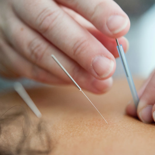 insertion of hair-thin needles at strategic points along the body