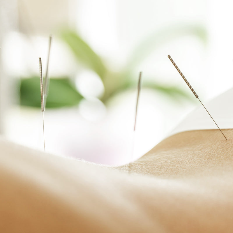 insertion of hair-thin needles at strategic points along the body